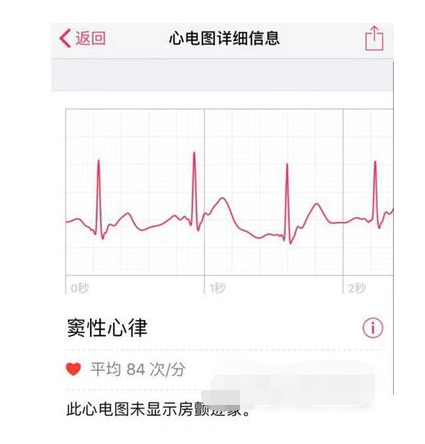 首页 苹果资讯 applewatch7心电图数据在哪查看 apple watch7这款手表