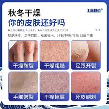 快手极速版进不去怎么办