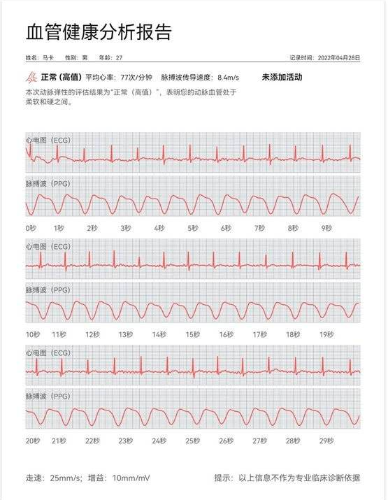 心电图怎么算心率图片